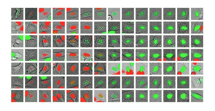AI is helping microbiologists to better understand the ‘cell cycle clock’